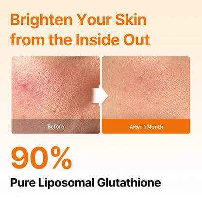 Glutathione Glow Strips